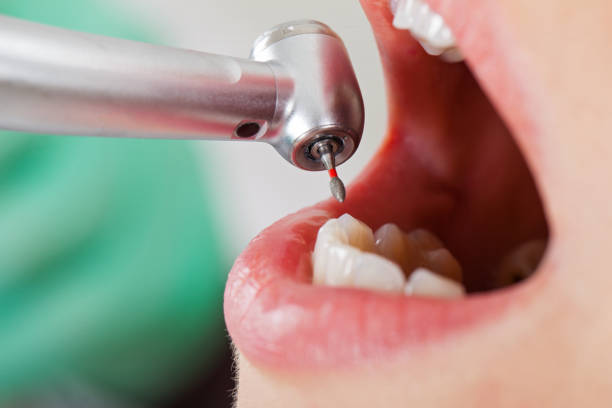 Best Emergency Gum Treatment in South Patrick Shores, FL